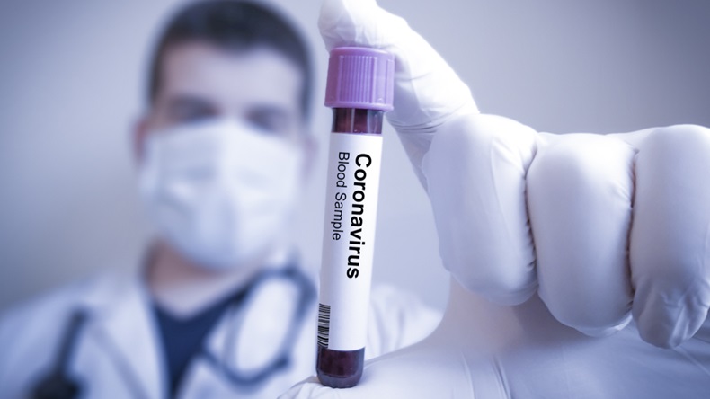 scientist holding a blood sample in a test tube to check for corona virus