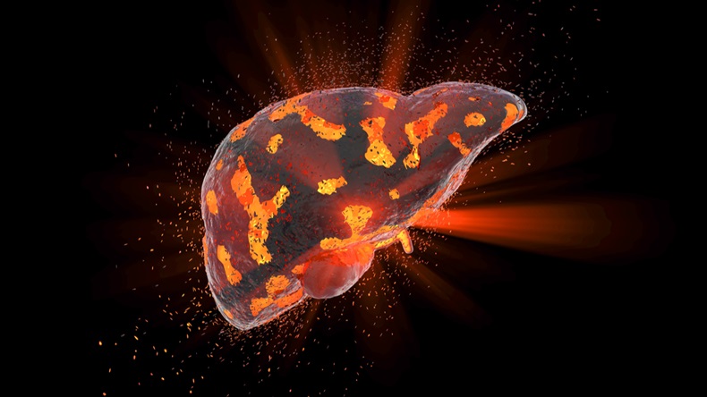 Conceptual image of liver damage as a result of drugs, viruses, toxins, bacteria, parasites, 3D illustration - Illustration 