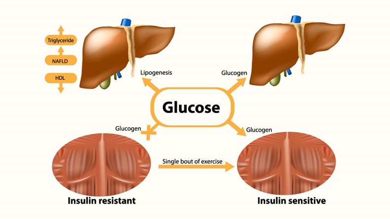 Glycogen in liver and muscle. Insulin sensitive and Insulin resistant. - Vector 
