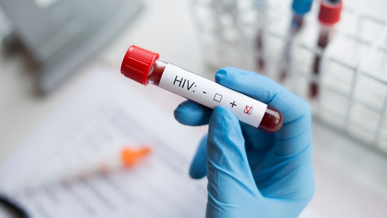 HIV_Blood_Test