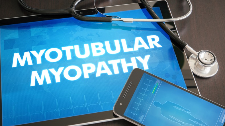 myotubular myopathy