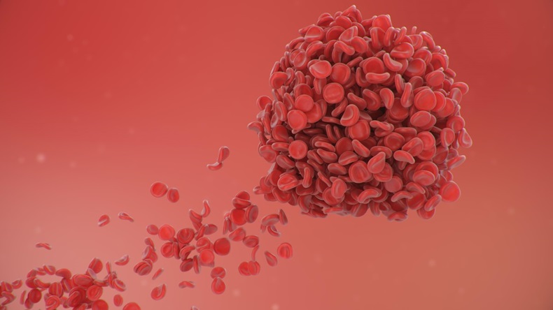 Red blood cells joining together to form a blood clot.