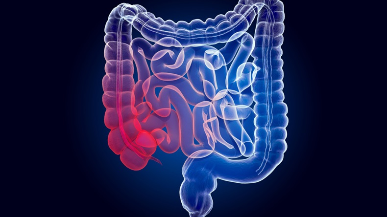 Pain in human intestines, bowel concept