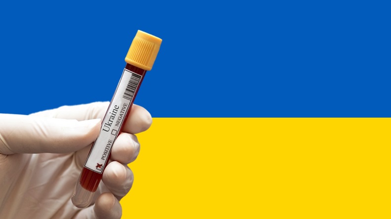 Ukraine with test tube