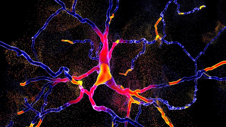 Parkinson's Disease dopaminergic neuron