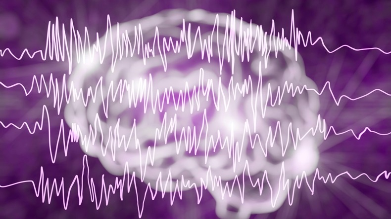 Epilepsy brain