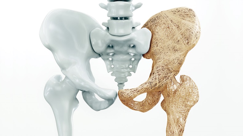 Osteoporosis upper limb bones - 3d rendering