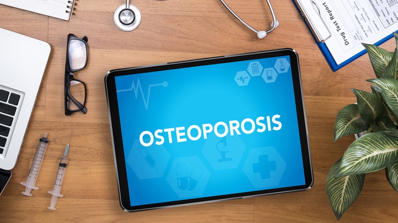 OSTEOPOROSIS Professional doctor use computer and medical equipment all around, desktop top view - Image 