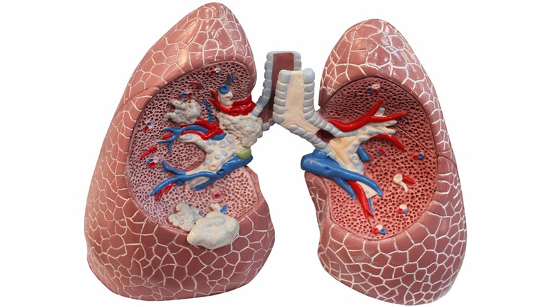Lung model